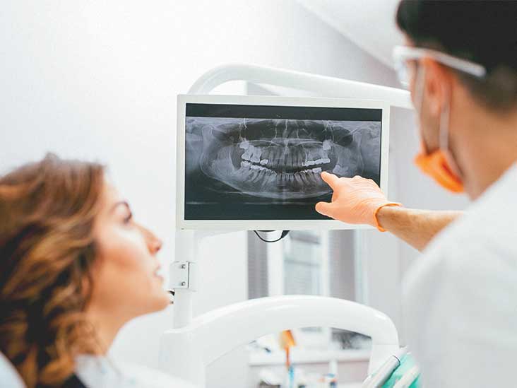 The Role of Dental X-Rays in Diagnosis and Treatment Planning
