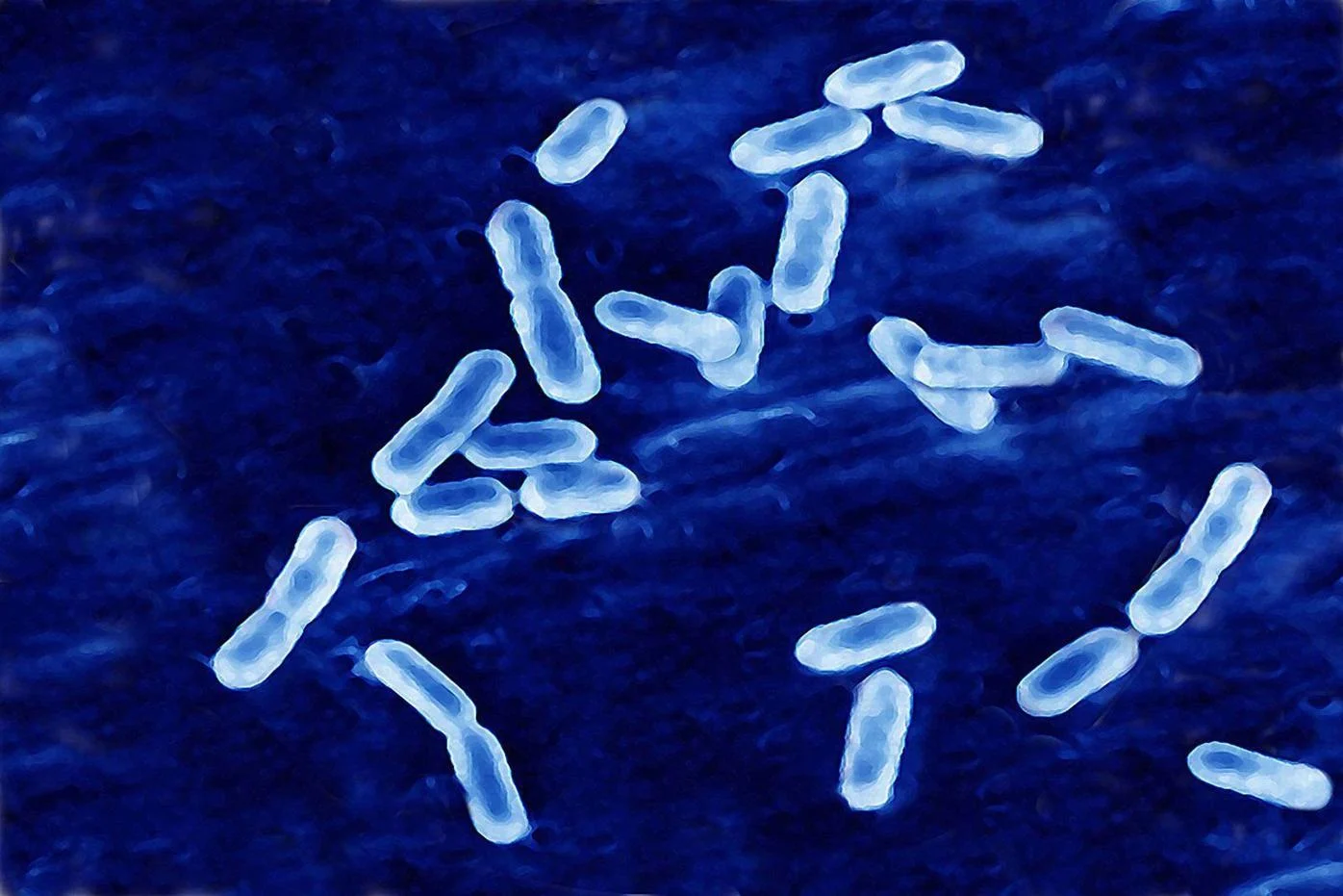 Listeria Bacteria Found in Milkshakes Sold at Tacoma Restaurant