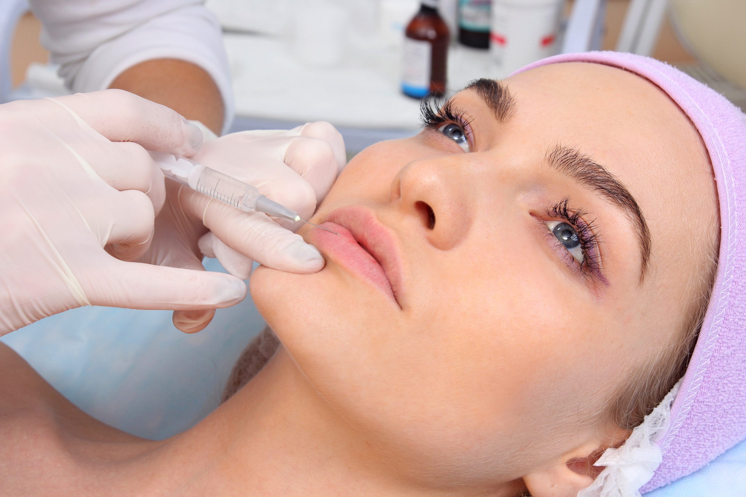 How Much Does Lip Augmentation Cost?
